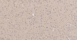 LC3B Antibody in Immunohistochemistry (Paraffin) (IHC (P))