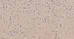 LC3B Antibody in Immunohistochemistry (Paraffin) (IHC (P))