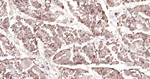 LC3B Antibody in Immunohistochemistry (Paraffin) (IHC (P))