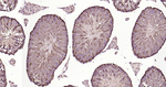 LC3B Antibody in Immunohistochemistry (Paraffin) (IHC (P))