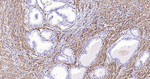 Calponin 1 Antibody in Immunohistochemistry (Paraffin) (IHC (P))