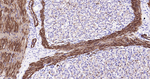 Calponin 1 Antibody in Immunohistochemistry (Paraffin) (IHC (P))