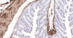 Calponin 1 Antibody in Immunohistochemistry (Paraffin) (IHC (P))