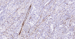 Calponin 1 Antibody in Immunohistochemistry (Paraffin) (IHC (P))