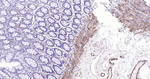 Calponin 1 Antibody in Immunohistochemistry (Paraffin) (IHC (P))