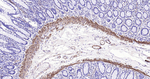 Calponin 1 Antibody in Immunohistochemistry (Paraffin) (IHC (P))