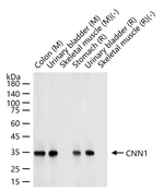 Calponin 1 Antibody in Western Blot (WB)