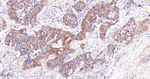 Asparagine Synthetase Monoclonal Antibody (2A9)