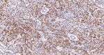 Asparagine Synthetase Antibody in Immunohistochemistry (Paraffin) (IHC (P))