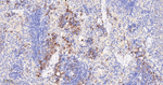 Asparagine Synthetase Antibody in Immunohistochemistry (Paraffin) (IHC (P))