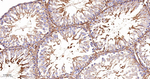 Asparagine Synthetase Antibody in Immunohistochemistry (Paraffin) (IHC (P))