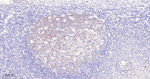 Asparagine Synthetase Antibody in Immunohistochemistry (Paraffin) (IHC (P))