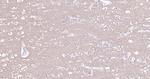 Synapsin 1 Antibody in Immunohistochemistry (Paraffin) (IHC (P))