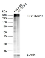 IGF2R Antibody in Western Blot (WB)