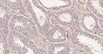 Acetylated Lysine Recombinant Rabbit Monoclonal Antibody (6E11)