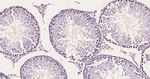 Acetylated Lysine Antibody in Immunohistochemistry (Paraffin) (IHC (P))