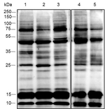Acetylated Lysine Antibody in Western Blot (WB)