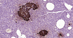 NOTCH1 Antibody in Immunohistochemistry (Paraffin) (IHC (P))