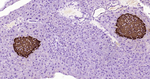 NOTCH1 Antibody in Immunohistochemistry (Paraffin) (IHC (P))