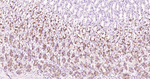 NOTCH1 Antibody in Immunohistochemistry (Paraffin) (IHC (P))