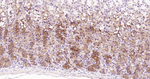 NOTCH1 Antibody in Immunohistochemistry (Paraffin) (IHC (P))