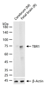 TBR1 Antibody in Western Blot (WB)