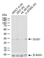 OLIG1 Recombinant Rabbit Monoclonal Antibody (2B3)