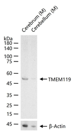 TMEM119 Antibody in Western Blot (WB)