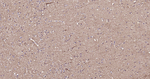 NF-H Antibody in Immunohistochemistry (Paraffin) (IHC (P))