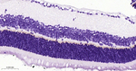 PSD-95 Antibody in Immunohistochemistry (Paraffin) (IHC (P))