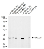 VGLUT1 Recombinant Rabbit Monoclonal Antibody (2G5)