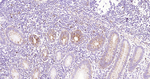 Glutaminase Antibody in Immunohistochemistry (Paraffin) (IHC (P))