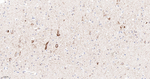Glutaminase Antibody in Immunohistochemistry (Paraffin) (IHC (P))