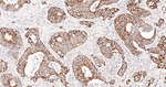 Glutaminase Antibody in Immunohistochemistry (Paraffin) (IHC (P))