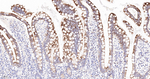 Glutaminase Antibody in Immunohistochemistry (Paraffin) (IHC (P))
