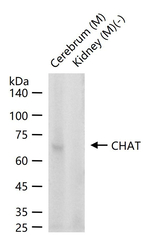 ChAT Antibody in Western Blot (WB)