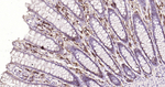 CD138 Antibody in Immunohistochemistry (Paraffin) (IHC (P))