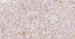 CD138 Antibody in Immunohistochemistry (Paraffin) (IHC (P))