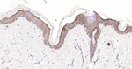 CD138 Antibody in Immunohistochemistry (Paraffin) (IHC (P))