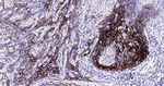 CD138 Antibody in Immunohistochemistry (Paraffin) (IHC (P))