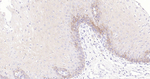 CD1a Antibody in Immunohistochemistry (Paraffin) (IHC (P))