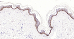 CD1a Antibody in Immunohistochemistry (Paraffin) (IHC (P))
