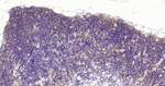 CD1a Antibody in Immunohistochemistry (Paraffin) (IHC (P))