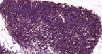 CD1a Antibody in Immunohistochemistry (Paraffin) (IHC (P))