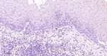 CD1a Antibody in Immunohistochemistry (Paraffin) (IHC (P))