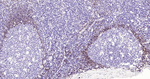 Human IgD Recombinant Rabbit Monoclonal Antibody (20D14)