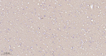 CD90 Antibody in Immunohistochemistry (Paraffin) (IHC (P))