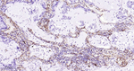 CD90 Antibody in Immunohistochemistry (Paraffin) (IHC (P))