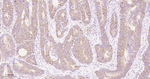 DPP4 Antibody in Immunohistochemistry (Paraffin) (IHC (P))