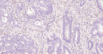 S100A4 Antibody in Immunohistochemistry (Paraffin) (IHC (P))